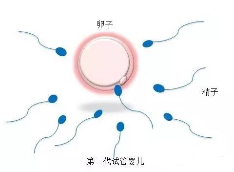 关于私人志愿者供卵助孕包生儿子
